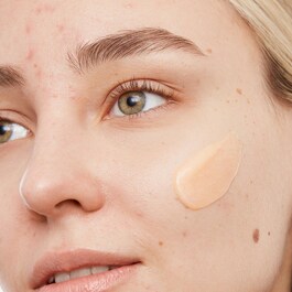 Gel de limpeza - Contra a acne