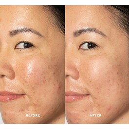 Glow2OH Dark Spot Toner - Loção tónica rosto concentrada em AHA