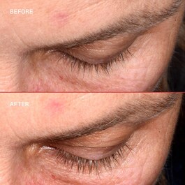 Lashbond™ - Sérum para pestanas