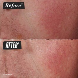 Kiehl’s Ultra Facial Advanced Repair Barrier Cream - Creme Facial 