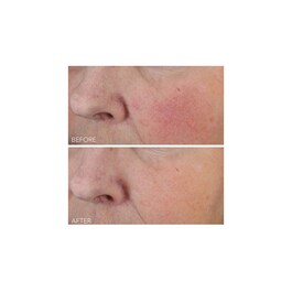 Vitamin C + Lactic - Cuidado Hidratante Intenso Firmeza Lift