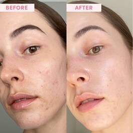 The product image is missing!
