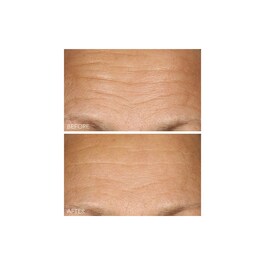 Vitamin C + Lactic - Sérum Concentrado 15% com Vitamina C Firmeza e luminosidade