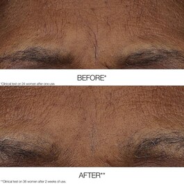 Clinique Smart Clinical Repair™ - Bálsamo Retinoide AM/PM