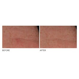Advanced Retinol + Ferulic - Cuidado Concentrado de Noite Antirrugas