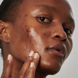 Excess oil solution with 20% niacinamide - Sérum Purificante