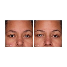 DermInfusions - Gel Regeneração Rápida