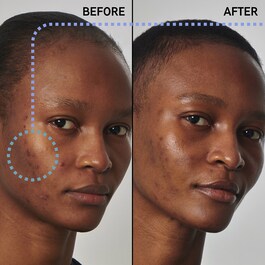 Excess oil solution with 20% niacinamide - Sérum Purificante