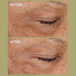 Plantscription™ Rétinol Encapsulé - Creme de Olhos