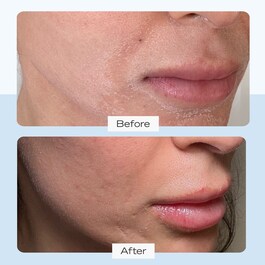 Ultra Repair Cream - Creme Hidratante  Rosto e Corpo