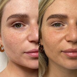 The Face - Gotas Auto-Bronzeadoras