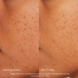 Daily Microfoliant - Esfoliante enzimático e mecânico suave