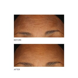 Alpha Beta® - Peeling Diário Fórmula Intensa