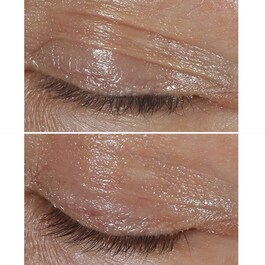 Clinique Smart Clinical Repair - Creme Contorno Ocular