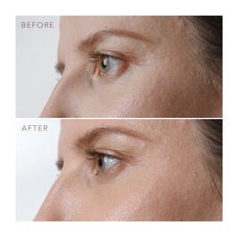 Iris™ Firming Pm - Sérum Contorno Ocular