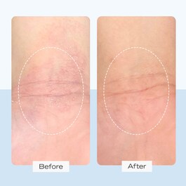 Ultra Repair Cream - Creme Hidratante  Rosto e Corpo