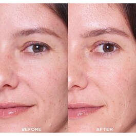 Dewtopia 25% Acid Flash Facial - Máscara esfoliante facial