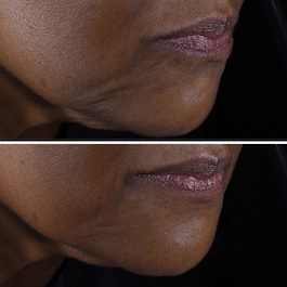Smart Clinical Repair- Creme Lift Anti Rugas
