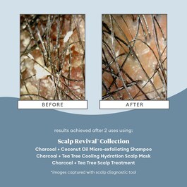 Scalp Revival Charcoal + Coconut Oil - Champô esfoliante