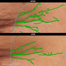Lift & Firm - Creme de olhos suavizante e refirmante 