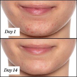 U.F.O. - Óleo facial anti-imperfeições