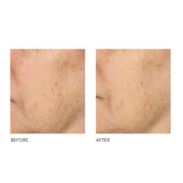 Alpha Beta® - Peeling Diário Fórmula Universal