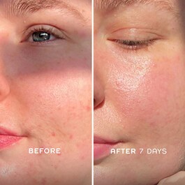 Evercalm™ - Elixir Reparador Facial