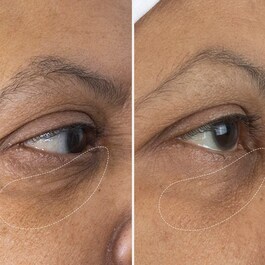 The Eye Cream Nomad - Creme de Olhos