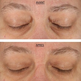 FAB Skin Lab Retinol & Hyaluronic Acid Eye Cream - Creme Contorno Ocular