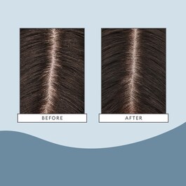 Scalp Revival - Máscara Hidratante e Refrescante Capilar
