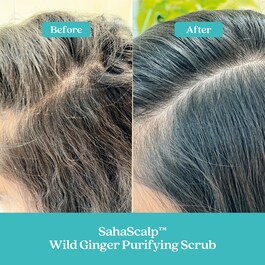 SahaScalp™  Scalp Reset Kit - Coffret Cuidados de Cabelo