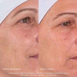 Dynamic skin retinol Sérum - Sérum Anti-Rugas