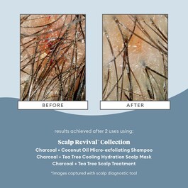 Scalp Revival Charcoal + Coconut Oil - Champô esfoliante