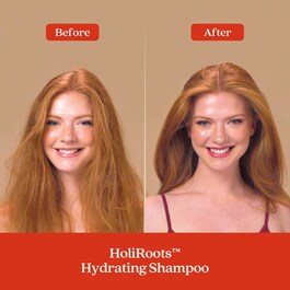 HoliRoots™ Shampoo - Champô Hidratante 