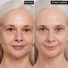 Sérum antienvelhecimento com retinol