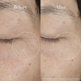 Tea Elixir Skin Resilience Activating Serum - Sérum com ácido hialurónico
