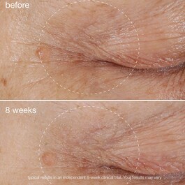 Biolumin-C Eye Serum - Serum Olhos Éclaircissant à la Vitamine C