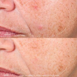 Retinol Clearing Oil - Óleo de Limpeza Retinol 