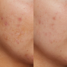 B3 Nice 10% Niacinamide - Sérum