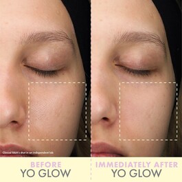 Yo Glow Mini - Esfoliante facial - Tamanho de viagem