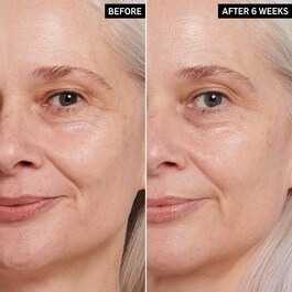 Creme para olhos antienvelhecimento com retinol