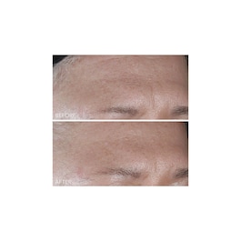 Vitamin C + Lactic - Cuidado Hidratante Intenso Firmeza Lift