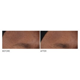 Advanced Retinol + Ferulic - Cuidado Concentrado de Noite Antirrugas