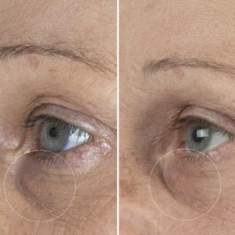 The Eye Cream Nomad - Creme de Olhos
