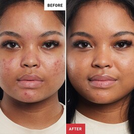 Super BB Au Ginseng - BB Cream Anti-Imperfeições