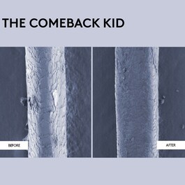 The Comeback Kid - Cuidado reparador instantâneo