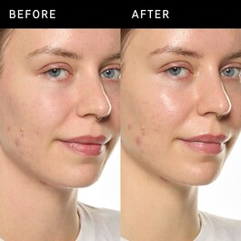 Ectoin Hydro-Barrier Serum - Sérum Hidratante e Protetor