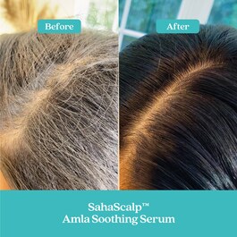 SahaScalp™  Scalp Reset Kit - Coffret Cuidados de Cabelo