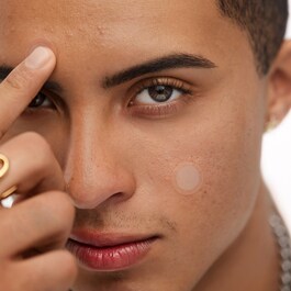 Patches para o tratamento da acne - Microperfuração