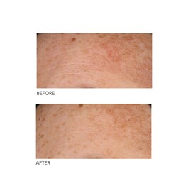 Alpha Beta® - Peeling Diário Fórmula Universal